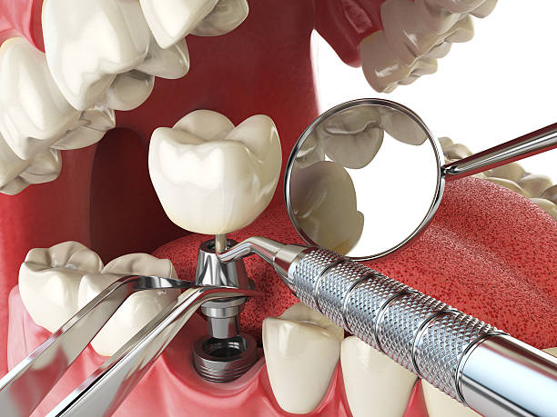 Best Emergency Treatment for Oral Infections in Shelton, NE